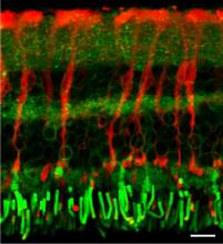 Confocal image