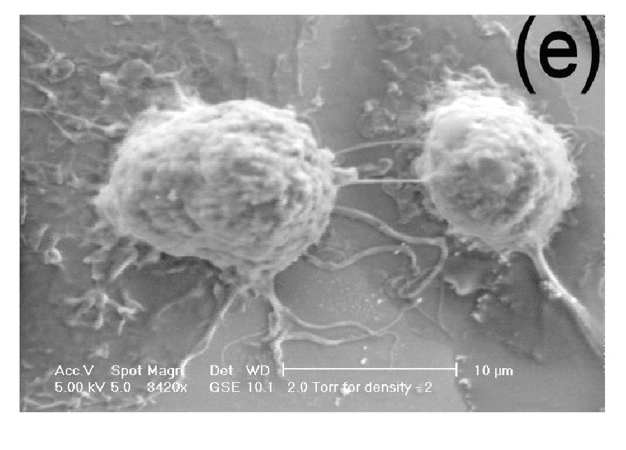ESEM image of human macrophages