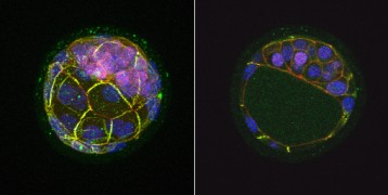 Mouse blastocyst displaying expression of the Nanog genes