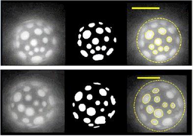 Images of Giant Unilamellar Vesicles, visualized by fluorescence microscopy.