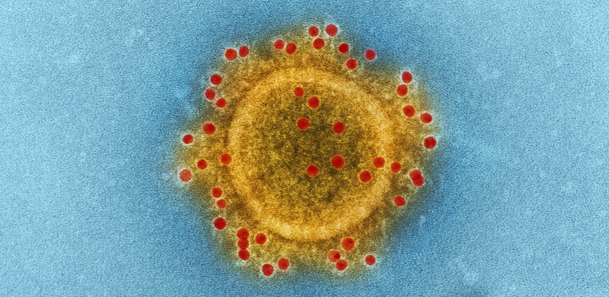 highly magnified, digitally colorized transmission electron microscopic (TEM) image highlights the particle envelope of a single, spherical shaped, Middle East respiratory syndrome coronavirus (MERS-CoV) virion