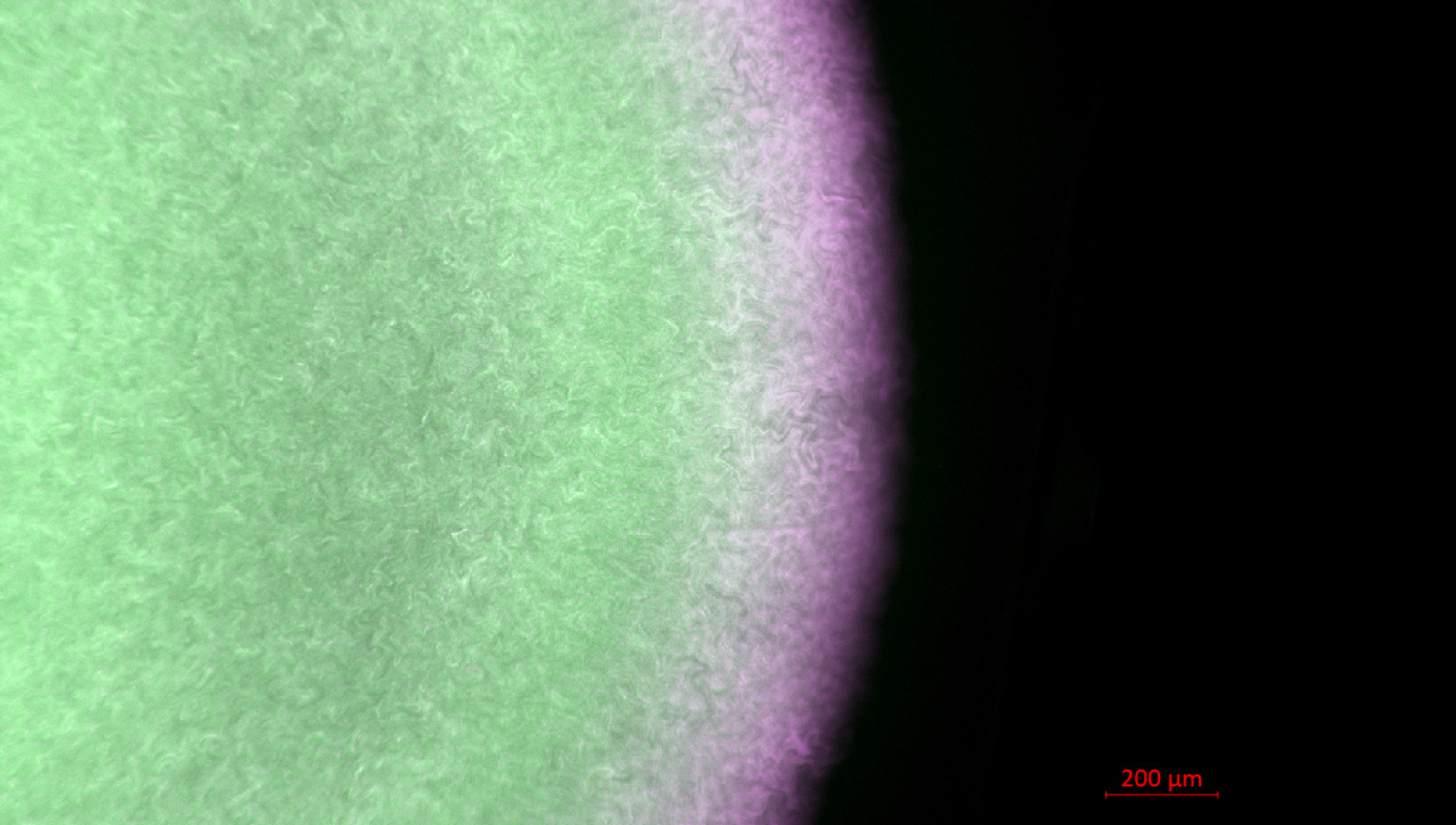 A Division of Microscopic Labor: How single bacteria team up to build a community Even simple microscopic bacteria work as a team to build complex living communities. In this vibrant snapshot of a day-old Escherichia coli colony, different jobs are assigned to distinct zones: glowing green highlights the "builders" weaving a protective glue to anchor the colony, while magenta marks the "swimmers" forming an outer ring prepared for movement. A closer look reveals individual cells chaining, dividing, and jostling against one another. As single microbes crowd, push, and cooperate at the microscopic level, they create striking, ring-like patterns that lay the template for multicellular biofilm development.