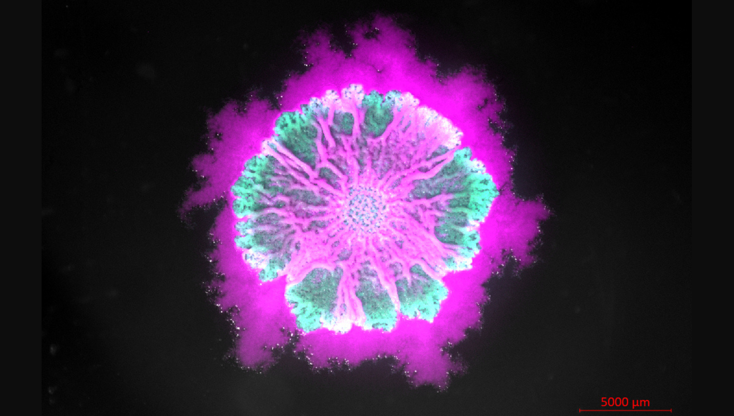 Bacterial Art in Bloom: The swimmers, the builders, and the living tapestry What happens when two flawed microbes are forced to live together? In this vibrant biofilm image, two defective strains of Bacillus subtilis unite to build a thriving community: glowing magenta "swimmers" (which can move but lack sticky glue) and glowing green "builders" (which produce the protective matrix glue but cannot move). Overlaid with standard light microscopy, the image captures their microscopic spatial dance. Through localized growth and spatial crowding, the two populations drive the colony to fold and buckle into stunning 3D patterns across the surface.